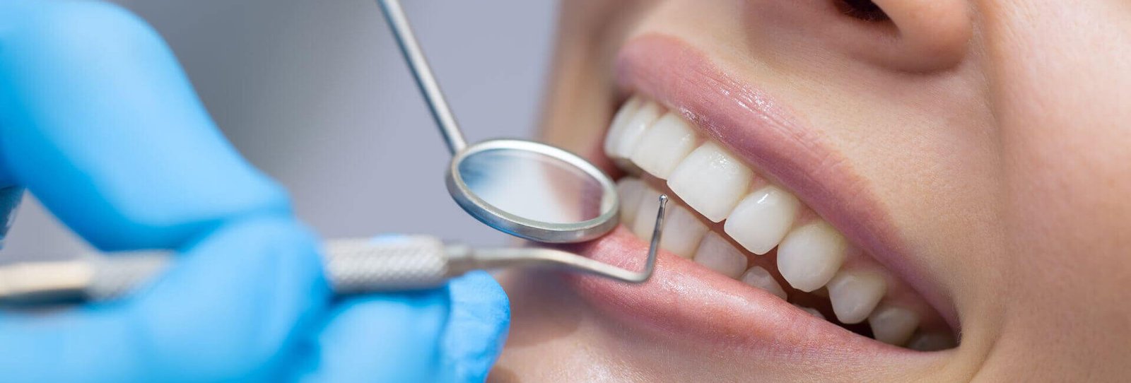 Everything You Need to Know About Dental Implants